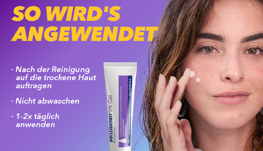 BENZAKNEN 5 % gel, 15 ml