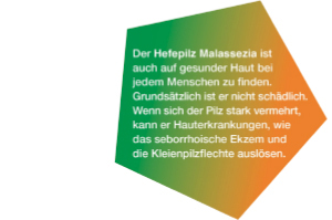 KETOZOLIN 2% sjampo, 120 ml