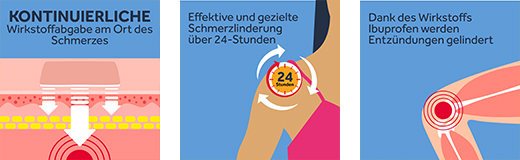 NUROFEN 24-timers smerteplaster 200 mg, 2 stk