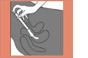 CLOTRIMAZOL AL 2 % vaginalkrem, 20 g