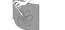 CLOTRIMAZOL AL 200 vaginaltabletter, 3 stk