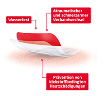 LEUKOMED T plus hudsensitiv steril 8x10 cm, 5 stk