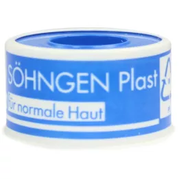SÖHNGEN PLAST 2,50 cmx5 m klebende gips, 1 stk