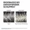 VICHY DERCOS Flasshindrende sjampo for tørr hodebunn, 200 ml