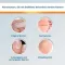 EndWarts® CLASSIC løsning, 3 ml