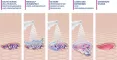 Instructions for use for MediGel® sårrensespray, 50 ml - 6