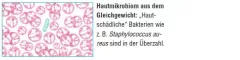 Instructions for use for AKTIVADERM ND Neurodermatitt hudbehandling aktive probiotika, 250 g - 2