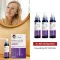 MINOXIDIL DoppelherzPharma 20 mg/ml oppløsning for kvinner, 3X60 ml